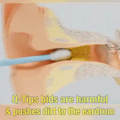 Earwax cleaning tool set